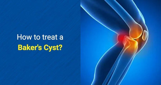 How to treat a Baker's Cyst by OSMO Patch