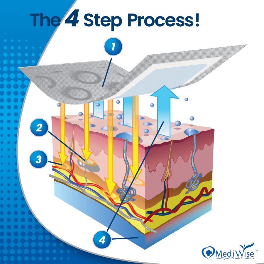 An explanatory diagram illustrating the OSMO Patch four-step process, showing a layered skin-like cross section with numbered callouts 1 through 4 and blue arrows indicating steps. 