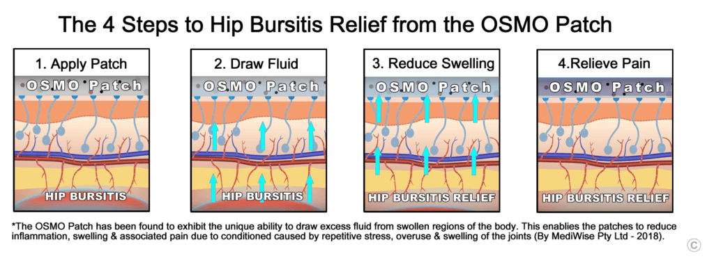 The 4 Steps to Hip Bursitis Relief from the OSMO Patch