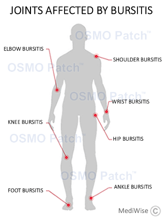 Bursitis Treatment OSMO Patch