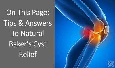 Baker’s Cyst Treatment and Natural Remedies | OSMO Patch US