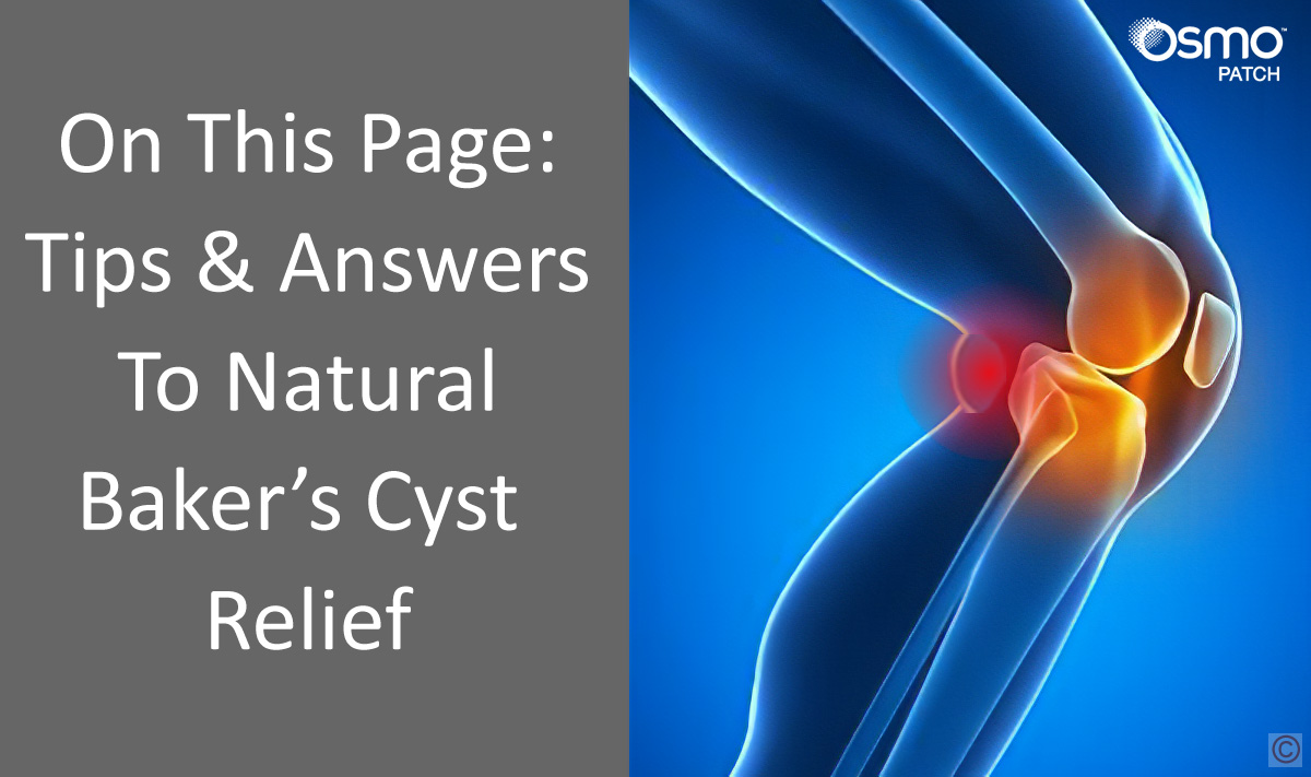 Baker’s Cyst Treatment and Natural Remedies | OSMO Patch US