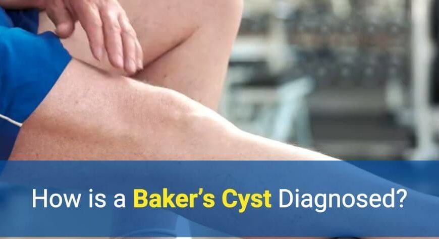 How is a Baker's Cyst diagnosed by OSMO Patch