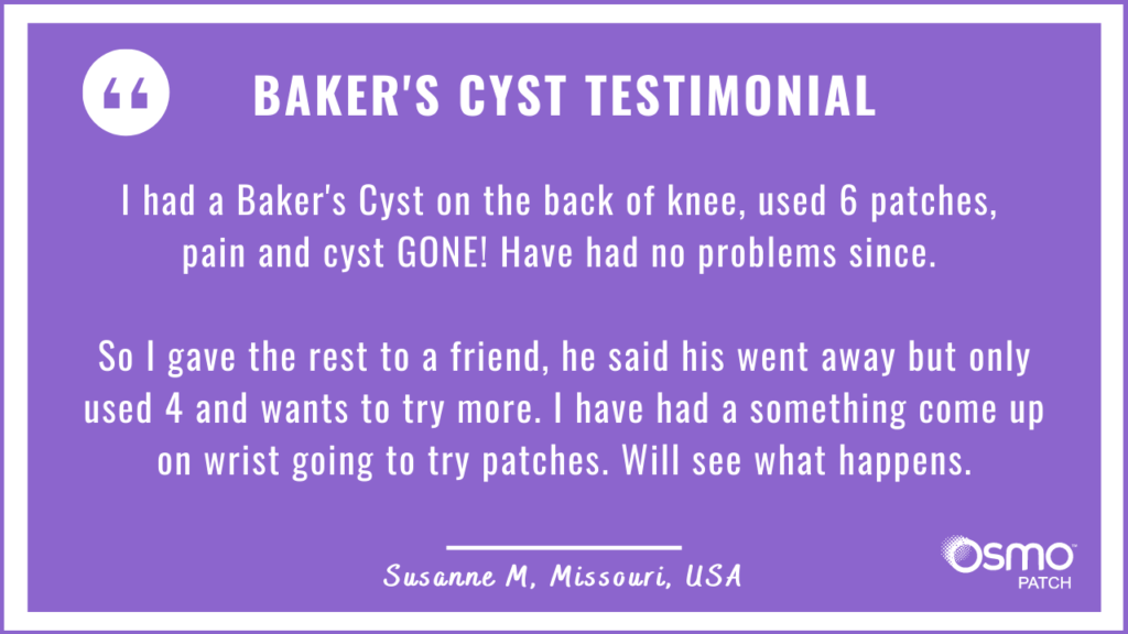 Testimonial: Baker's Cyst treatment with the OSMO Patch. Pain and Cyst gone!