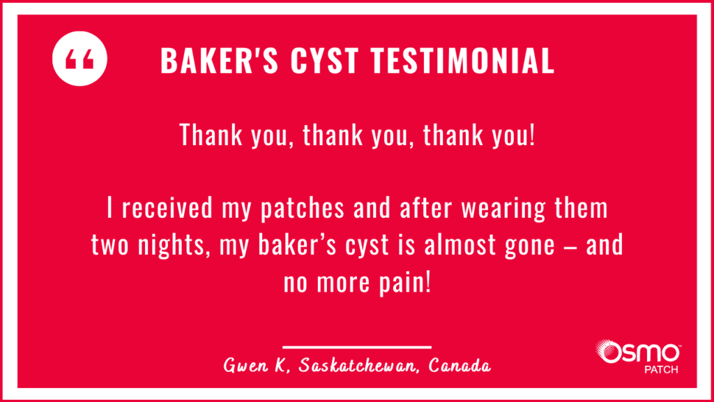 Testimonial: Two nights after wearing the OSMO Patch the Baker's Cyst is nearly gone, and no more pain!