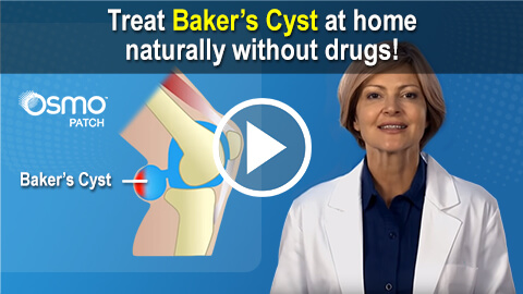 Treat Baker's Cyst at home naturally without drugs!