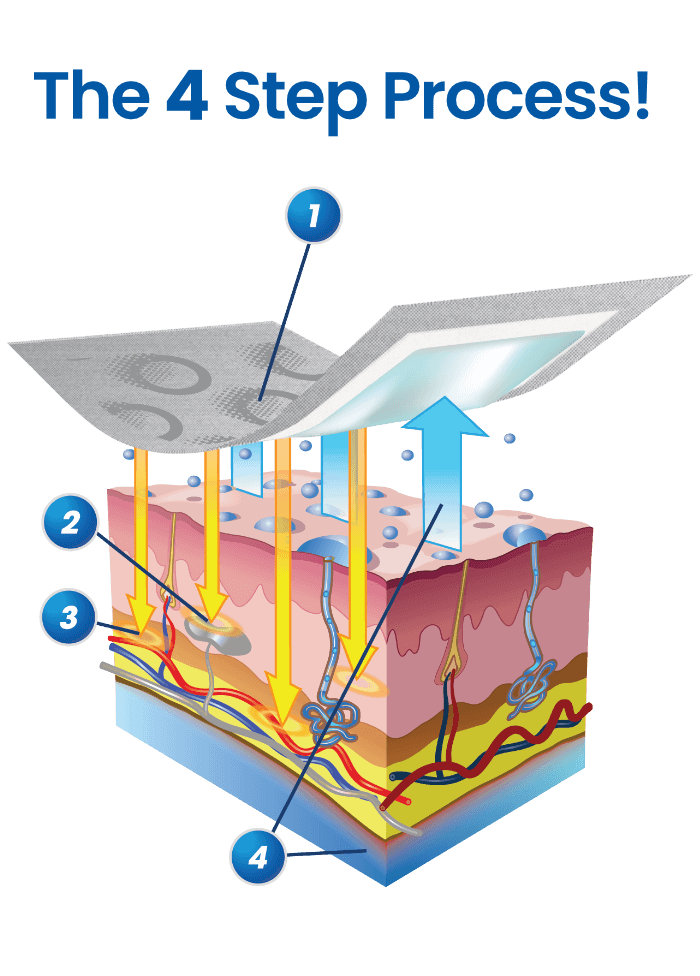 The OSMO Patch applied on a dermal layer, indicating where the 4 steps of the process take place.